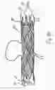 Fig. 04 - MEDICAL DEVICES INCLUDING METALLIC FILMS AND METHODS FOR MAKING SAME