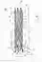 Fig. 05 - MEDICAL DEVICES INCLUDING METALLIC FILMS AND METHODS FOR MAKING SAME