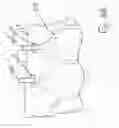 Fig. 17 - MEDICAL DEVICES INCLUDING METALLIC FILMS AND METHODS FOR MAKING SAME