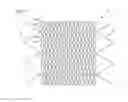 Fig. 08 - Stent and method of inserting a stent into a delivery catheter