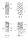 Fig. 07 - STENT GRAFT DELIVERY SYSTEMS AND ASSOCIATED METHODS