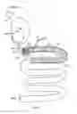 Fig. 04 - Transpyloric anchoring