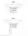 Fig. 06 - Lubricated valve for ostomy pouch
