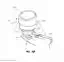 Fig. 08 - Patient interface for opthalmologic diagnostic and interventional procedures
