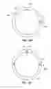 Fig. 35 - Patient interface for opthalmologic diagnostic and interventional procedures