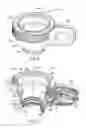 Fig. 06 - Vacuum loss detection during laser eye surgery