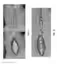 Fig. 22 - Negative pressure wound closure device