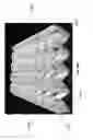 Fig. 44 - Negative pressure wound closure device