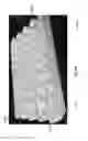 Fig. 45 - Negative pressure wound closure device