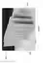 Fig. 51 - Negative pressure wound closure device