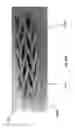 Fig. 52 - Negative pressure wound closure device