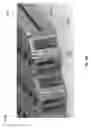 Fig. 71 - Negative pressure wound closure device