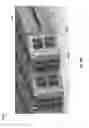 Fig. 72 - Negative pressure wound closure device