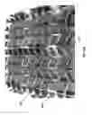 Fig. 75 - Negative pressure wound closure device