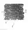 Fig. 76 - Negative pressure wound closure device