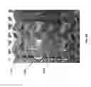 Fig. 77 - Negative pressure wound closure device