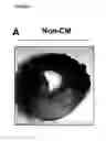 Fig. 02 - Mesenchymal stem cell particles