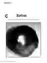Fig. 04 - Mesenchymal stem cell particles