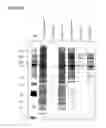 Fig. 20 - Mesenchymal stem cell particles