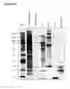 Fig. 22 - Mesenchymal stem cell particles