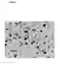 Fig. 26 - Mesenchymal stem cell particles