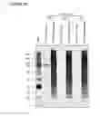 Fig. 27 - Mesenchymal stem cell particles