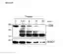 Fig. 33 - Mesenchymal stem cell particles