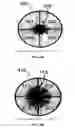 Fig. 05 - FICUS EXTRACTS HAVING ANGIOGENESIS INHIBITING ACTIVITY AND METHODS OF ISOLATING AND USING THE SAME