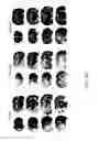 Fig. 22 - Method Of Reducing Injury To Mammalian Cells