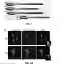Fig. 02 - Methods of treating metabolic disease