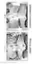 Fig. 09 - Compositions for treating joints comprising bone morphogenetic protein and hyaluronic acid