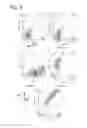 Fig. 06 - Combination for treating an inflammatory disorder