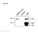 Fig. 03 - Vaccination by means of recombinant yeast by producing a protective humoral immune response against defined antigens