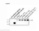 Fig. 04 - Vaccination by means of recombinant yeast by producing a protective humoral immune response against defined antigens