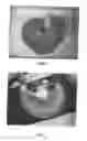 Fig. 04 - Implant and method for producing an implant