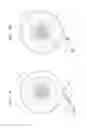 Fig. 02 - Injectable hydrogel implant for treating glaucoma