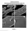 Fig. 08 - Methods, Systems, and Devices Relating to Directional Eluting Implantable Medical Devices
