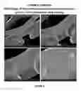 Fig. 09 - Methods, Systems, and Devices Relating to Directional Eluting Implantable Medical Devices