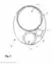 Fig. 04 - Method and device for infusion of pharmacologic agents and thrombus aspiration in artery