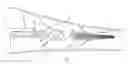 Fig. 01 - Systems and methods for limb treatment