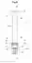 Fig. 06 - Outer cylinder for prefilled syringe and outer cylinder packaging for prefilled syringes