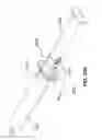 Fig. 17 - Methods and devices for autoflush syringes
