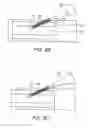 Fig. 28 - Vascular access device and guiding portion
