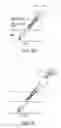 Fig. 32 - Vascular access device and guiding portion