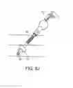 Fig. 33 - Vascular access device and guiding portion