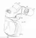 Fig. 01 - Forehead pad for respiratory mask