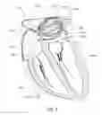 Fig. 03 - Medical device including manipulable portion with connected elongate members
