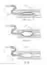 Fig. 03 - Balloon Catheter With Elastomeric Sheath and Methods