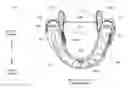 Fig. 01 - Method and apparatus for treating sleep apnea
