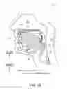 Fig. 02 - Method and apparatus for treating sleep apnea